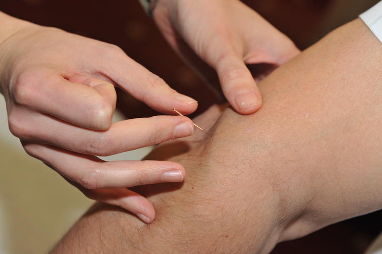 Chiropractic needle therapy relieving elbow pain